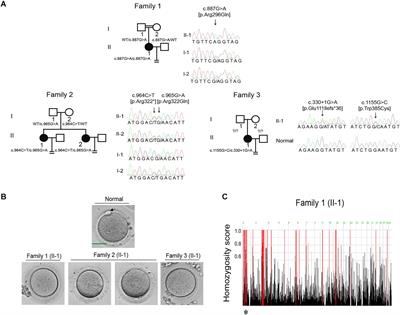 Identification of Novel Mutations in CDC20: Expanding the Mutational Spectrum for Female Infertility